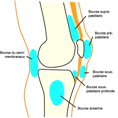 Illustration 1 — Bursopathie pré-rotulienne